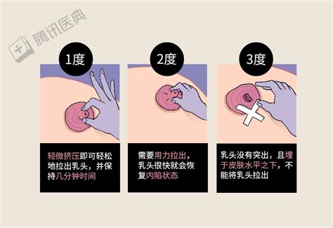 奶頭毛|不懂就问：乳头长毛毛正常吗？